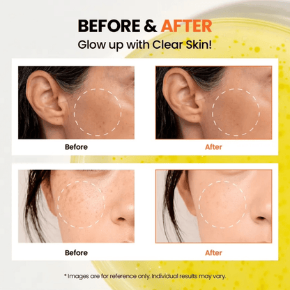 KSECRET Serum 30ml KSECRET SEOUL 1988 Glow Serum : Niacinamide 15% + Yuja