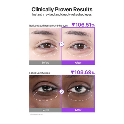 NUMBUZIN No.9 NAD Collagen Under Eye Patches