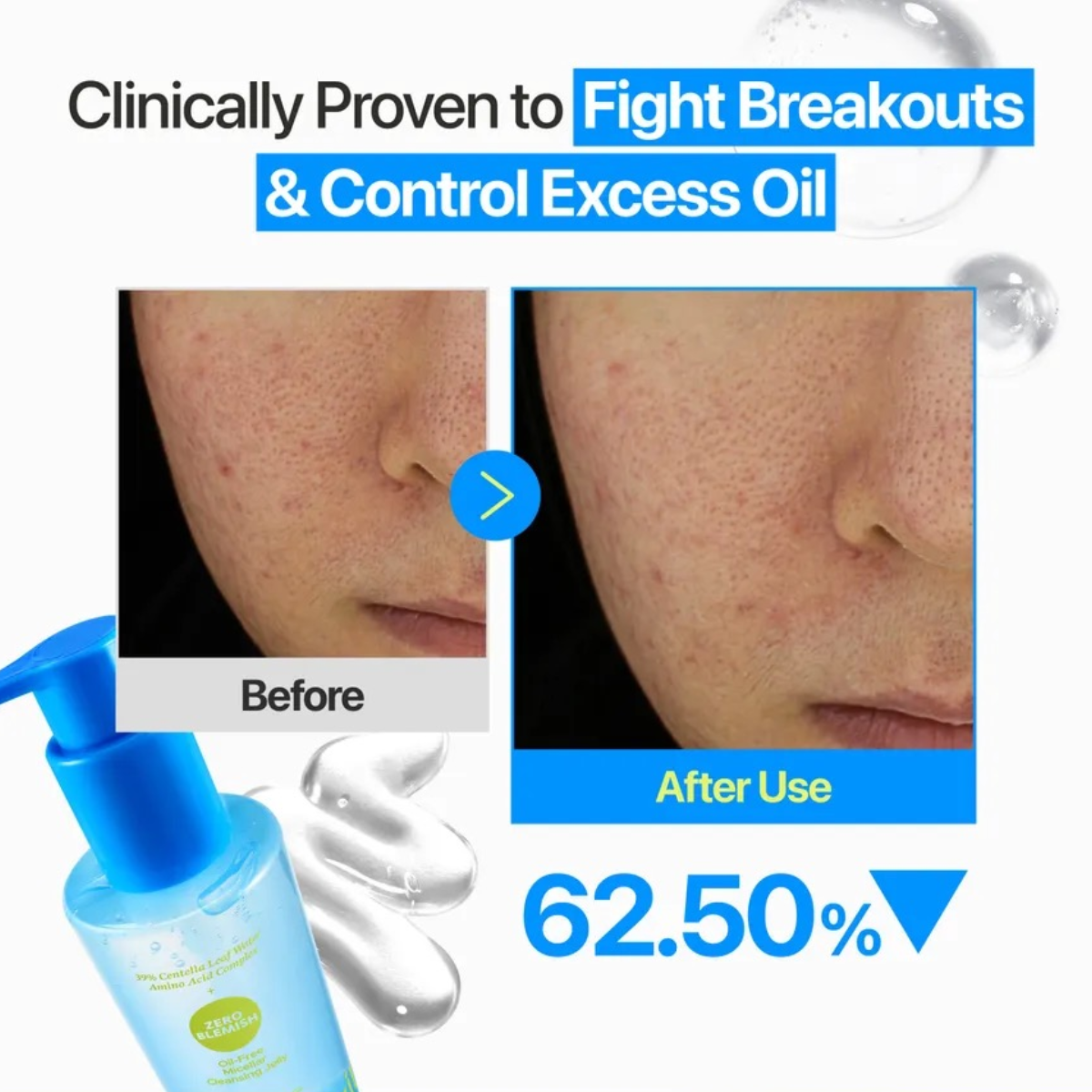 NUMBUZIN Zero Blemish Oil-Free Micellar Cleansing Jelly