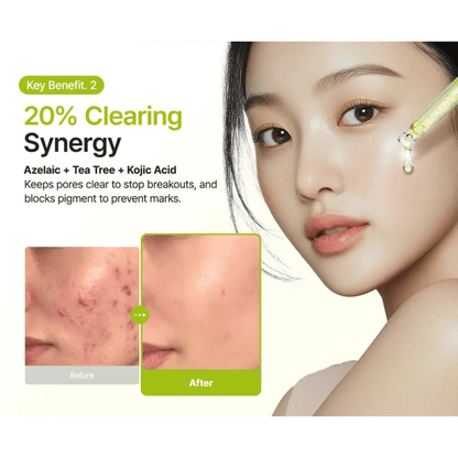 PURITO SEOUL Serum 30ml PURITO SEOUL Azelaic Acid 10 Kojic Tea Tree Serum