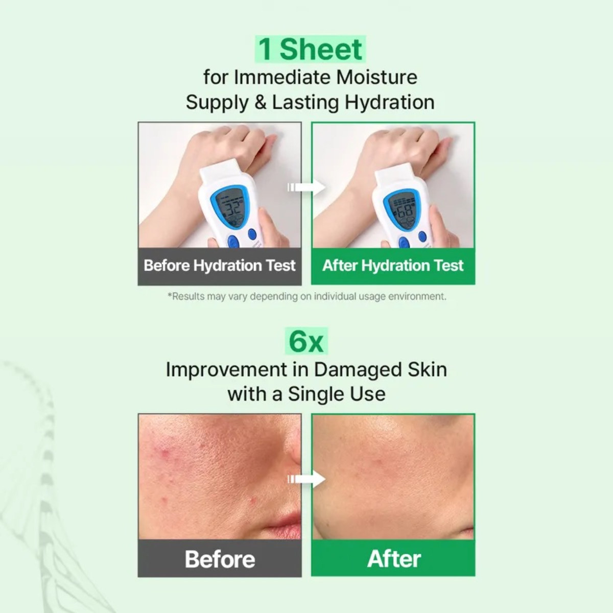 ZIPIDERM EGF Skin Barrier Dressing Mask Pack