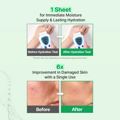 ZIPIDERM EGF Skin Barrier Dressing Mask Pack