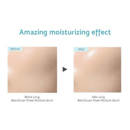 iUNIK Serum 50ml iUNIK Beta-Glucan Power Moisture Serum